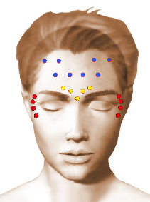 injection botox